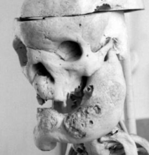 Collezione di Anatomia Patologica